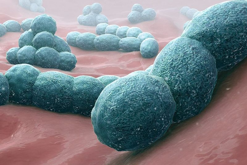 Streptococcus